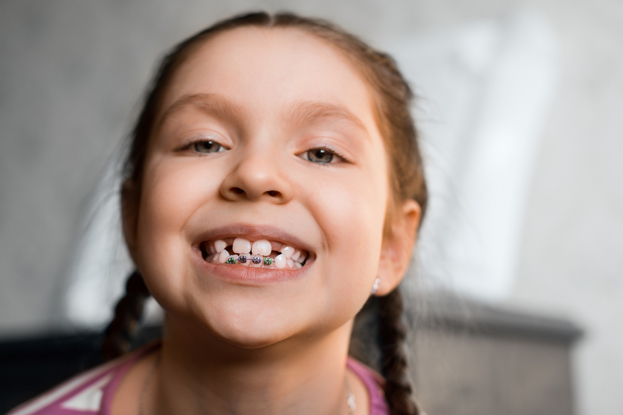 Pediatric Dentistry - moorestown smiles